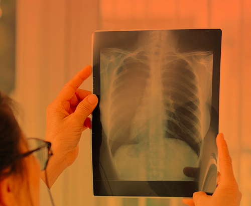 anestesia_event1_tcm2359-1257376